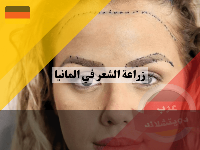 زراعة الشعر في المانيا للنساء