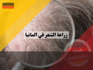 ما أشهر مدن لاجراء عمليات زراعة الشعر في المانيا‎